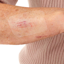 Leukomed T skin sensitive, steriler Transparentverband – im Einsatz